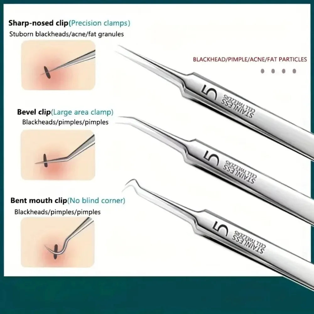 1-11PCS Stainless Steel Acne Clip, Cell Clip, Blackhead Clip, Acne Needle, Beauty Salon Acne Tool