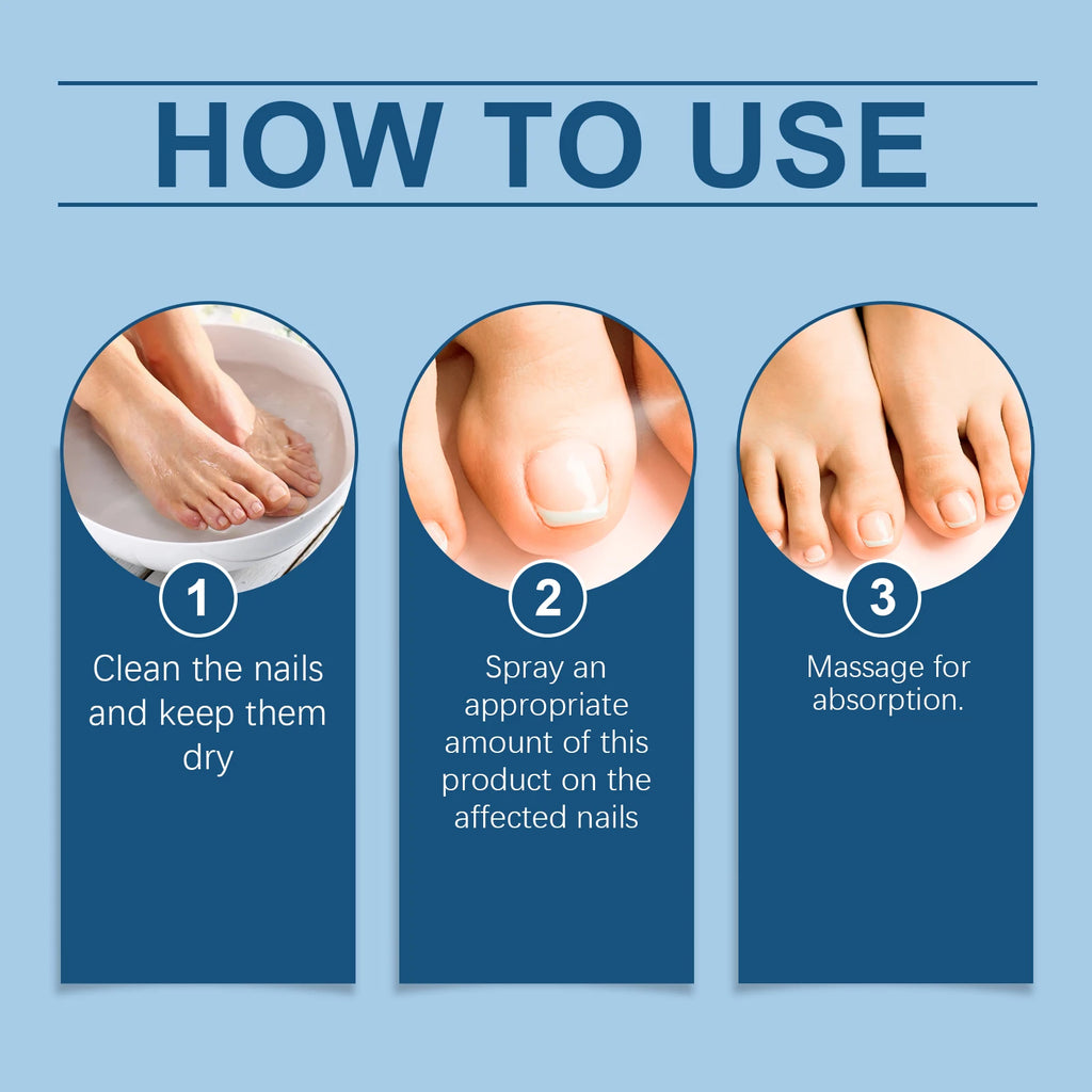 Nail Fungus Spray Anti Onychomycosis Paronychia Reduce Beriberi Promote Nail Growth Deodorant Antiperspirant Nail Soothing Spray