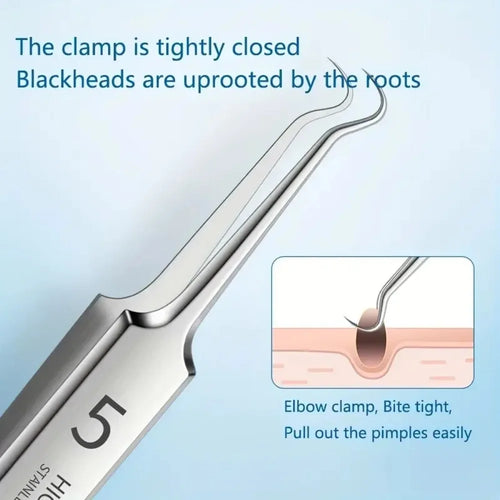 1-11PCS Stainless Steel Acne Clip, Cell Clip, Blackhead Clip, Acne Needle, Beauty Salon Acne Tool
