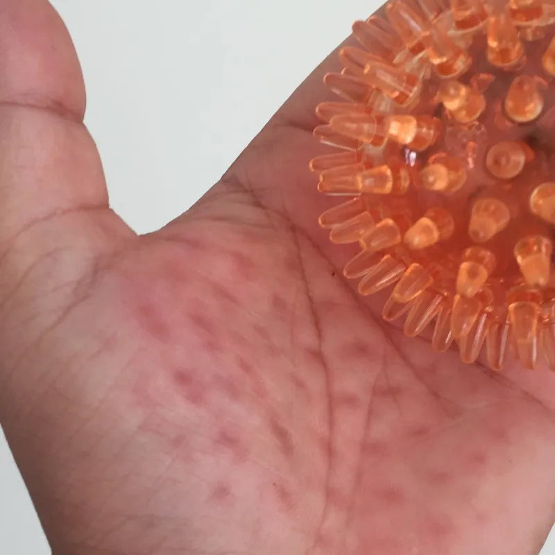 Spiky Ball Hollow Soft Transparent Strength Recovery Exercise Stress Relief Massage Ball for Hand Wrist